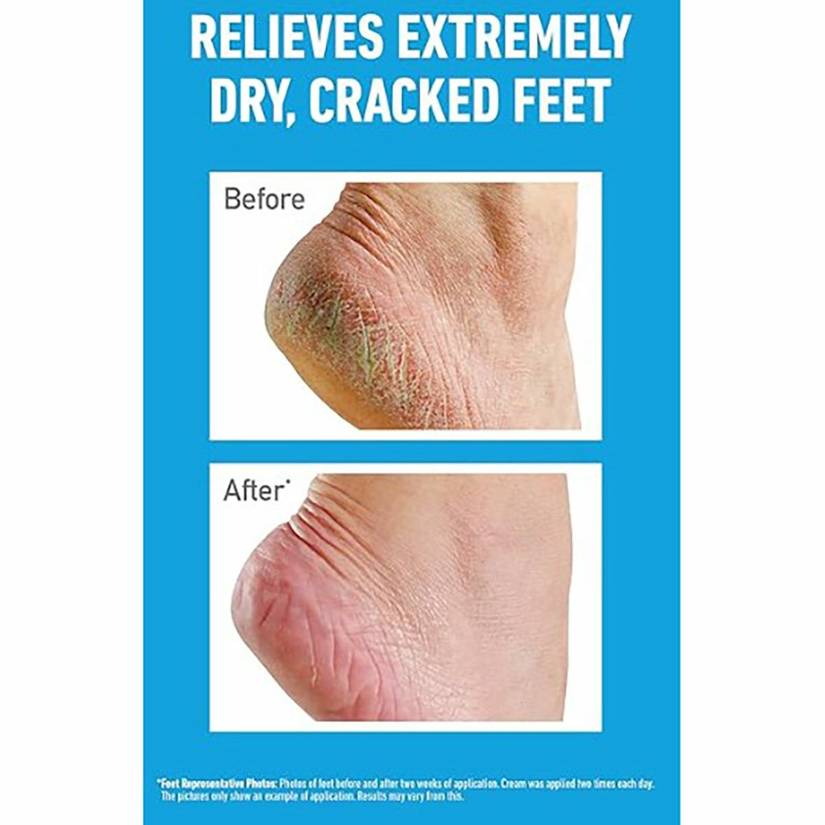 O'Keeffe's Healthy Feet Original, 2 x 180ml